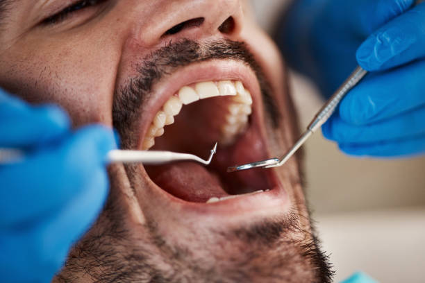 Best Emergency Dentist for Lost Fillings or Crowns in Orcdlands Estates, HI